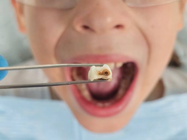Best Same-Day Emergency Dentist in Emah, OK